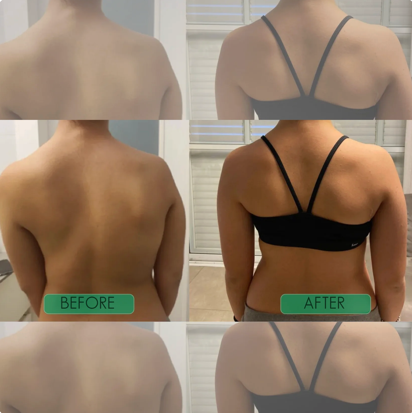 The Upright Corrector