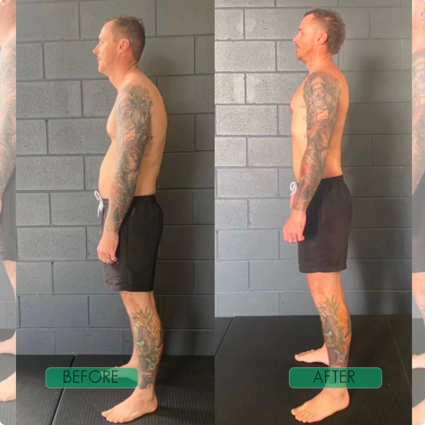 The Upright Corrector