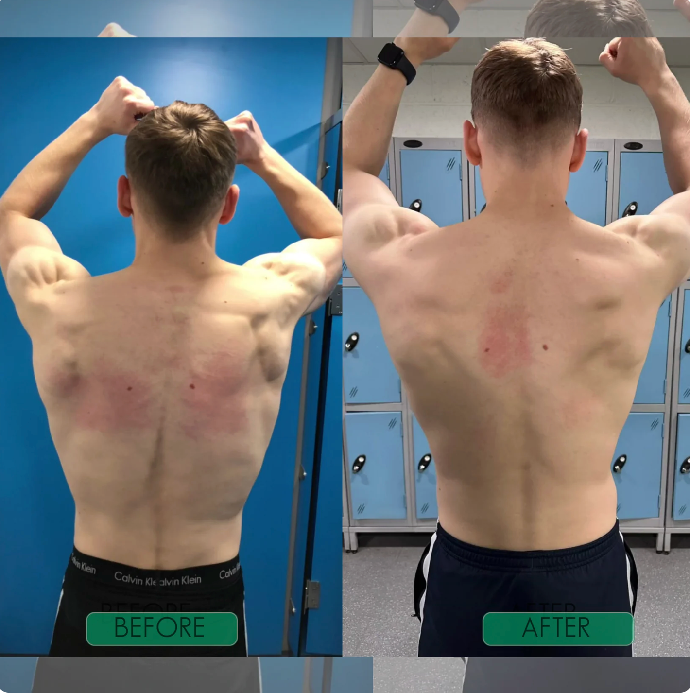 The Upright Corrector